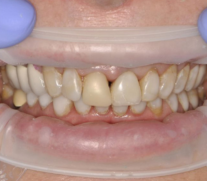 Before image