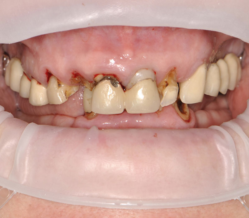 Before image