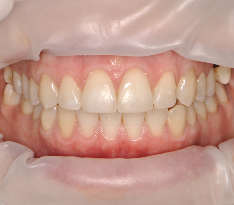 Before image