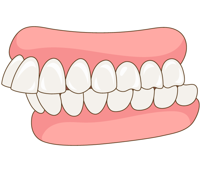 78