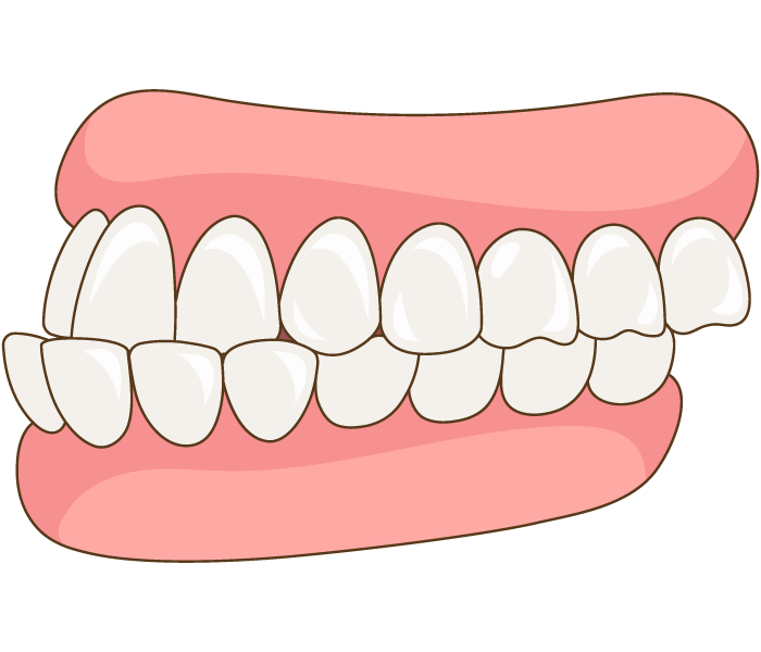 79