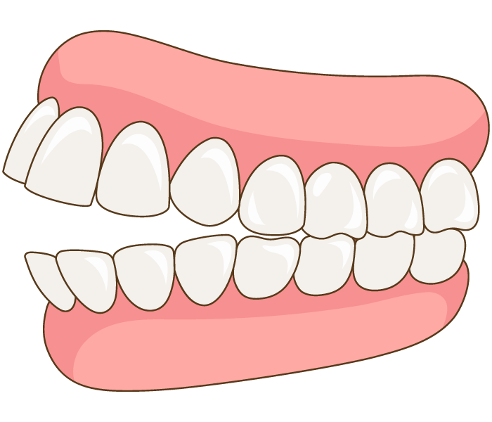 80