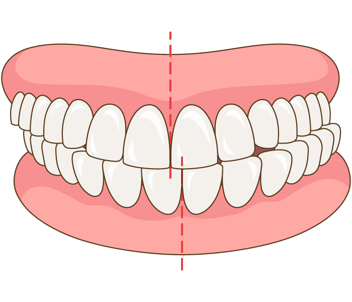 81