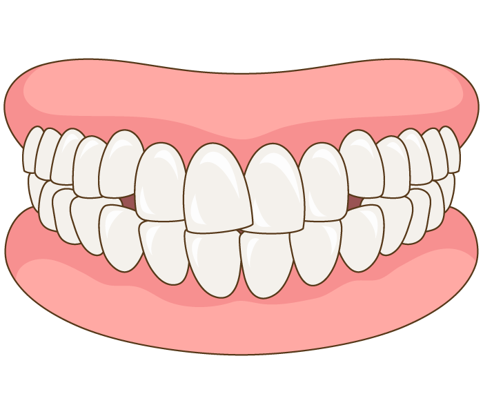 82