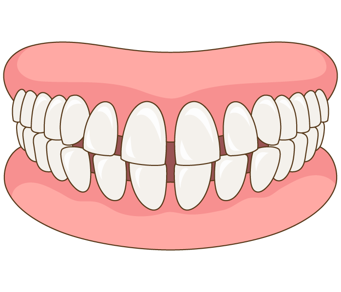 83