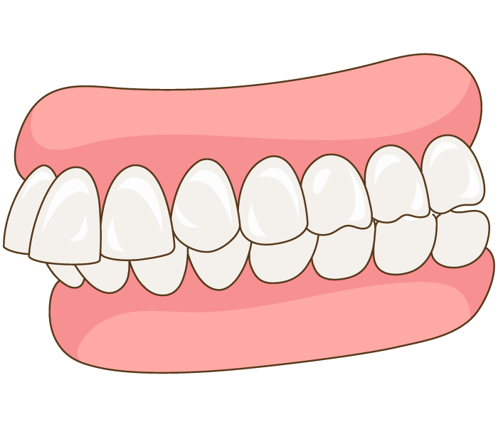 84